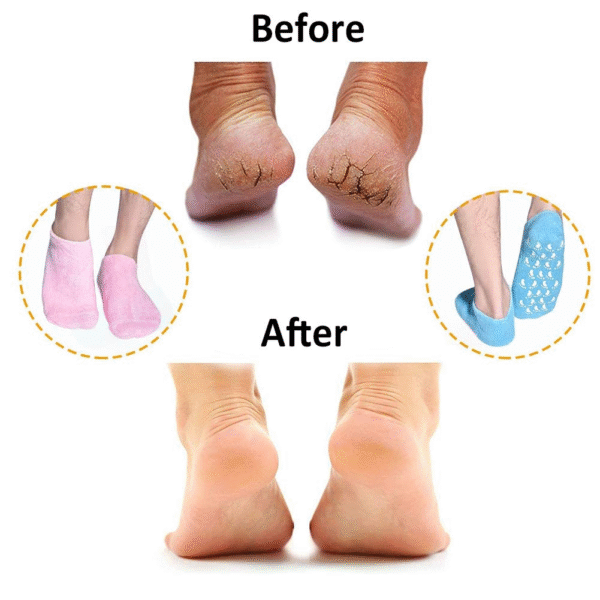 Pair of 02 Gel Spa Sock Moisturizing Cotton Silicon Moisturize Soften Repair Cracked Skin Beauty Foot Care for Dry Feet Skin Treatment Silicone Socks Infused with Vitamins Essential Oils - Image 4