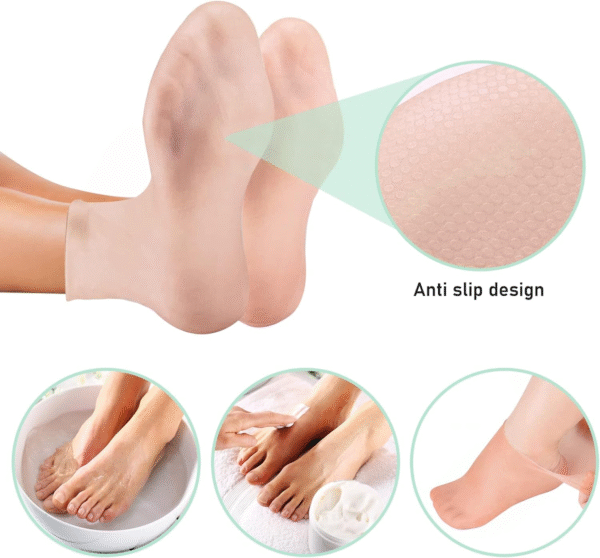 Pair of 02 Silicone Moisture Socks Anti Slip Aloe Socks for Dry Cracked Feet Women & Softening Dry Cracked Feet Rough Skin, Spa Gel Socks - Image 6